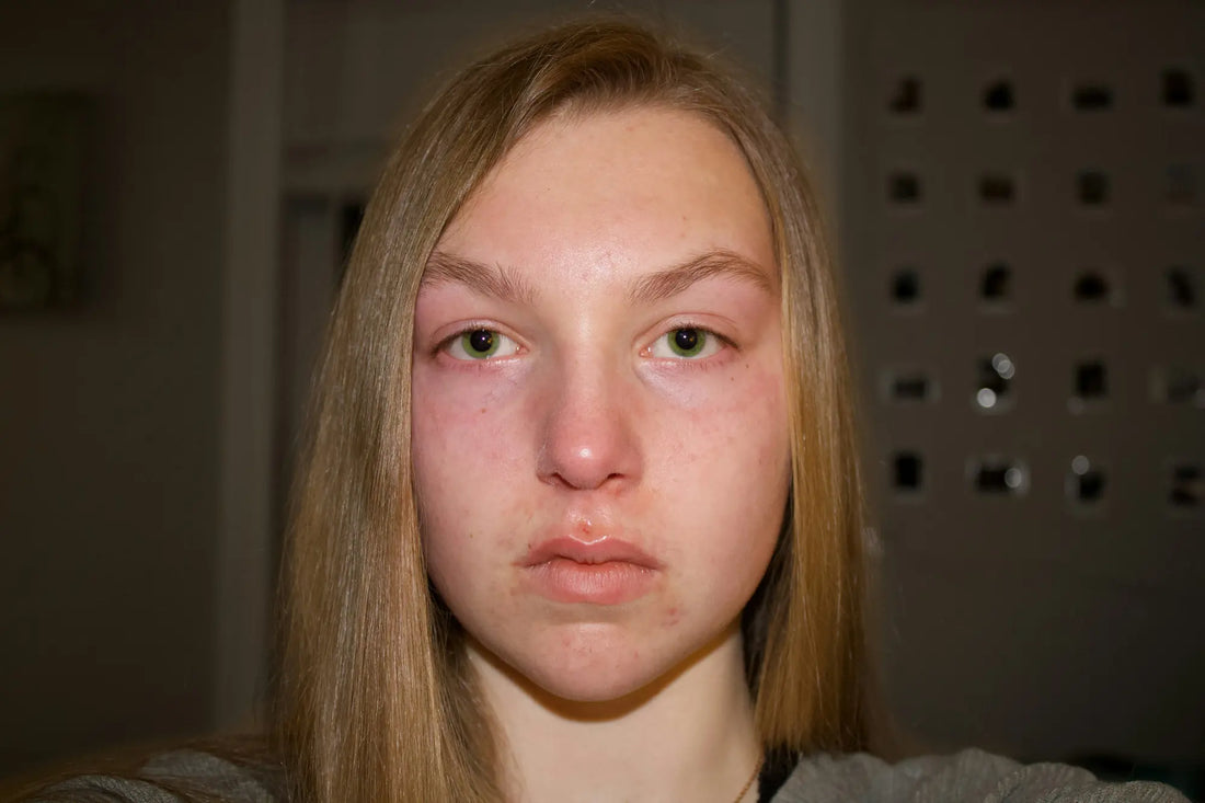 Infiammazione silenziosa