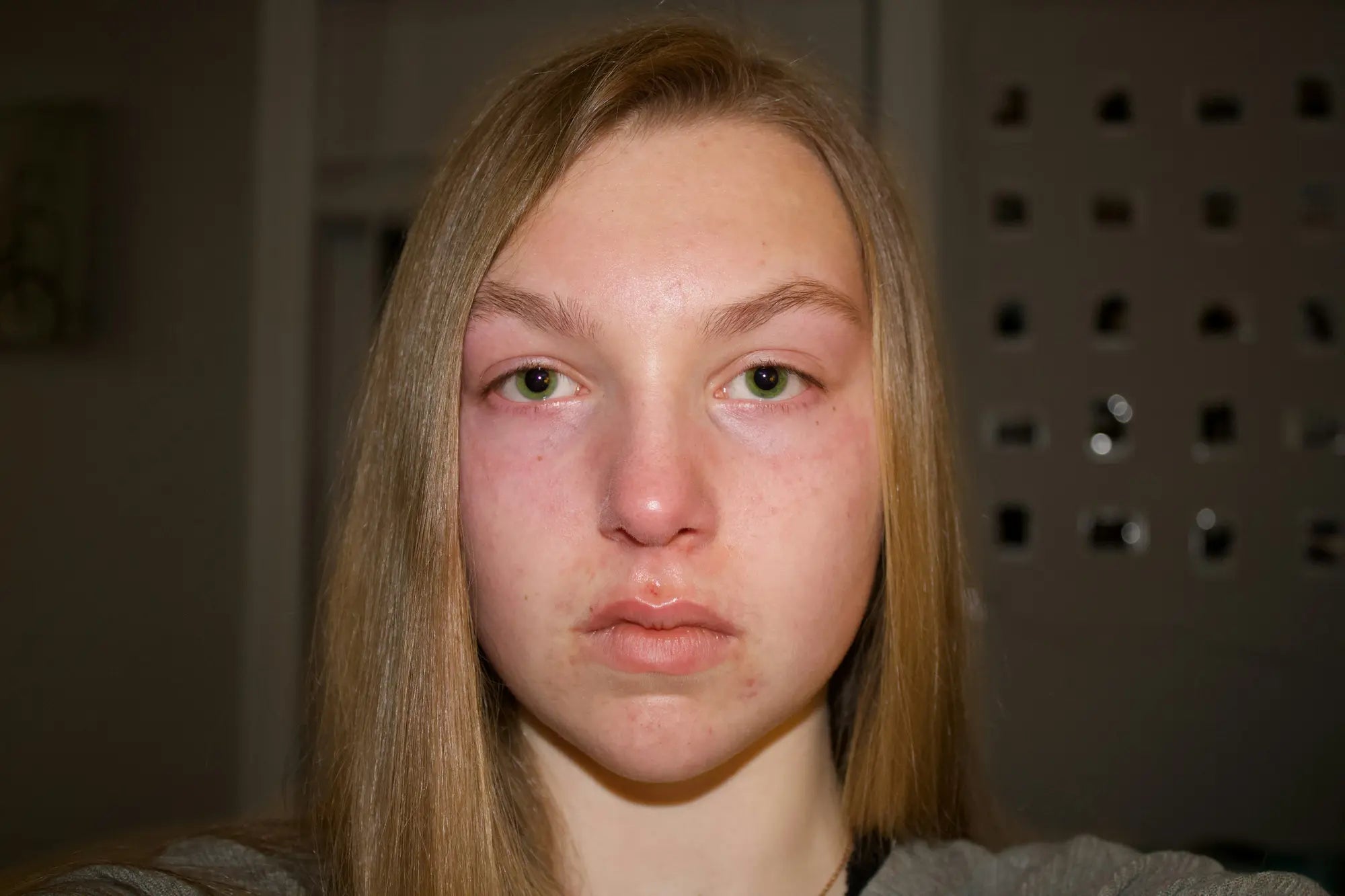 Infiammazione silenziosa